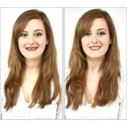 Kozmetikai műfogsor - felpattintható fogsor takaró 